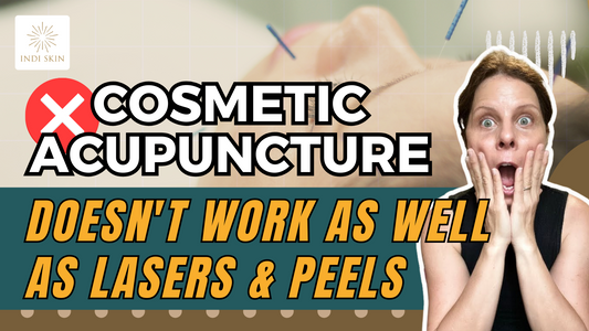 BEAUTY MYTH: "Cosmetic Acupuncture can’t transform skin texture as effectively as peels and laser treatments"