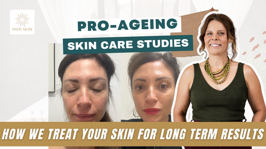 PRO AGEING CASE STUDY #1:  Treating REDNESS, BLIND PIMPLES, DRY SKIN