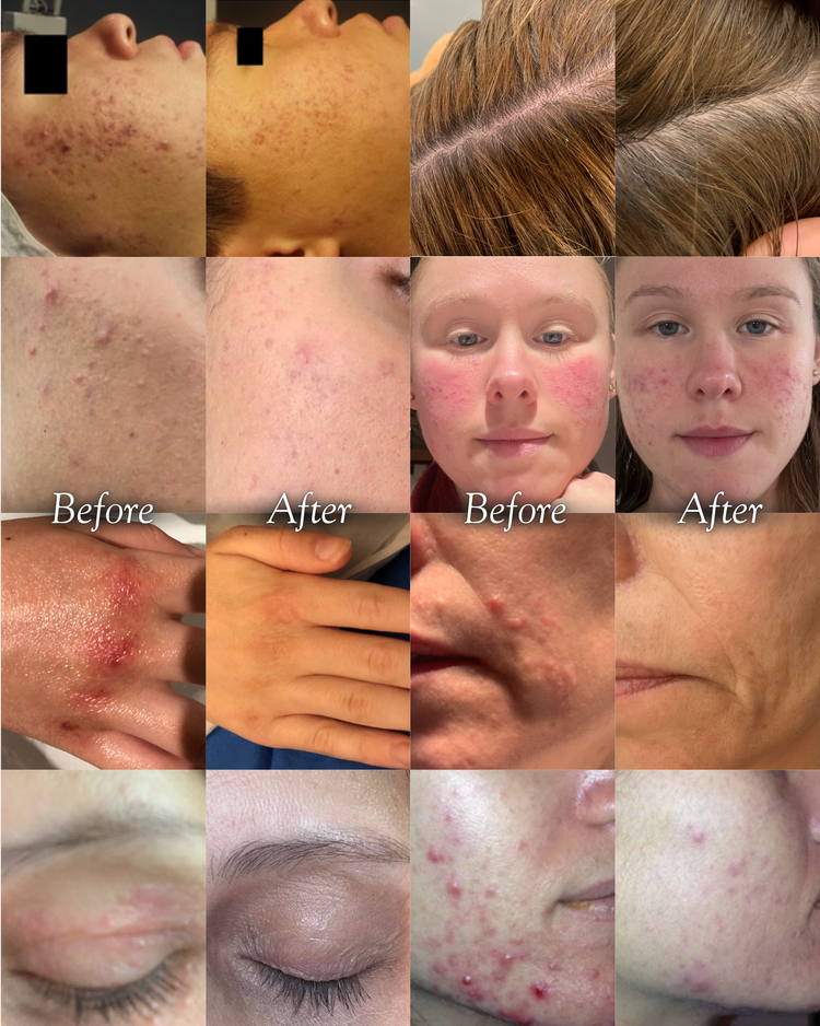 3-Month Chinese Medicine Dermatology Program – Indi Skin