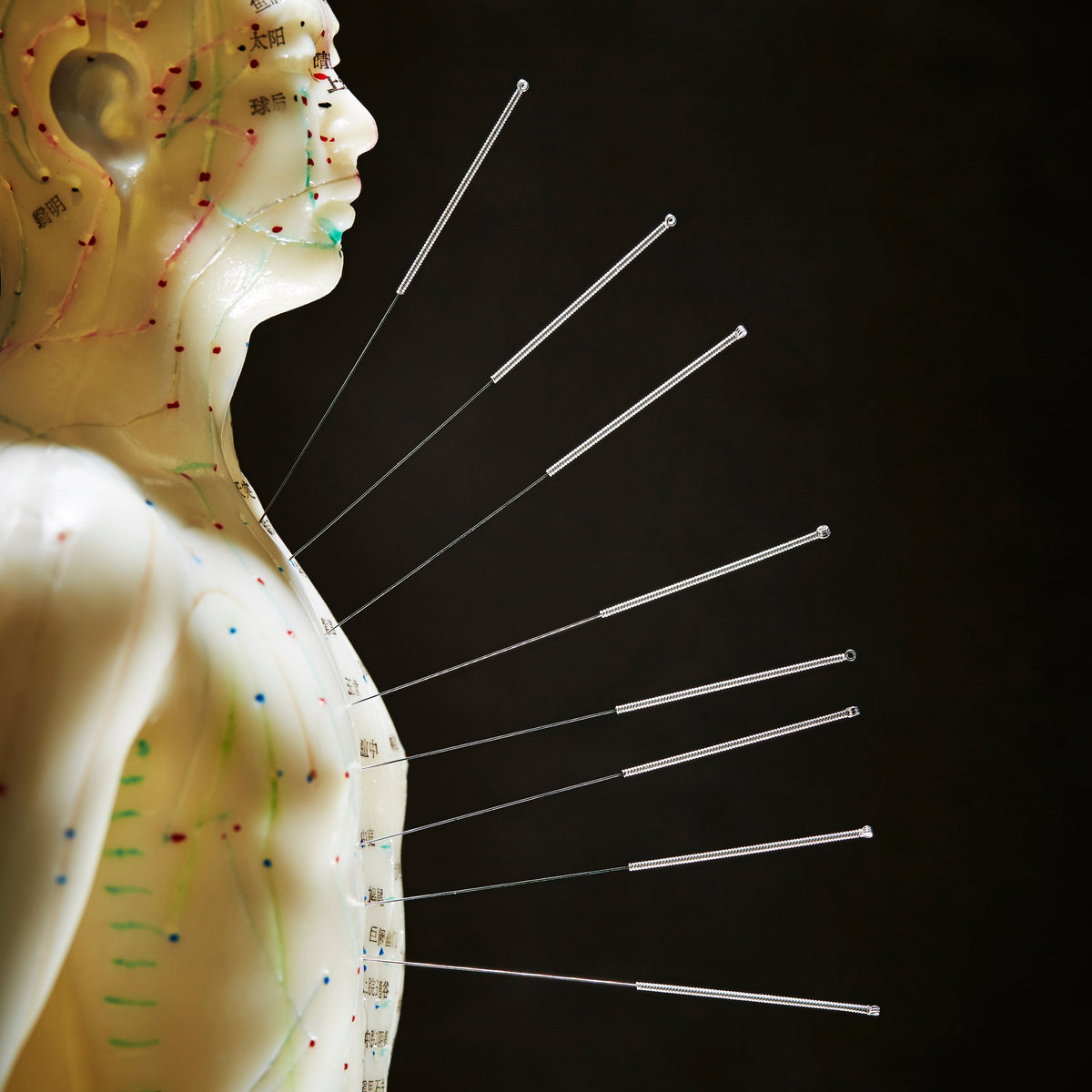 Traditional Chinese medicine acupuncture model showing meridian lines and acupuncture points